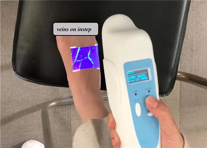 Professional vein finder MAS-S1